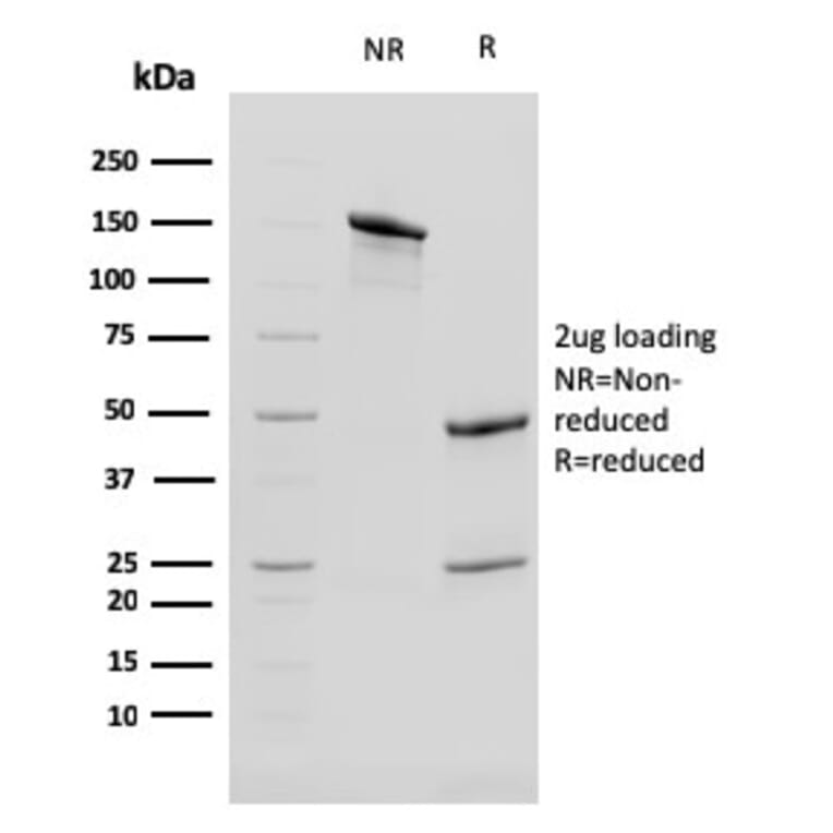 SDS-PAGE - Anti-Cytokeratin 13 Antibody [KRT13/2659] (A249171) - Antibodies.com