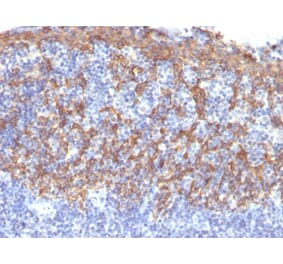 Immunohistochemistry - Anti-Cytokeratin 14 Antibody [LL002] (A249173) - Antibodies.com