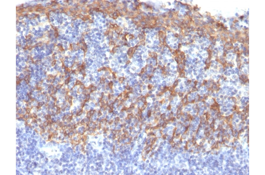 Immunohistochemistry - Anti-Cytokeratin 14 Antibody [LL002] (A249173) - Antibodies.com
