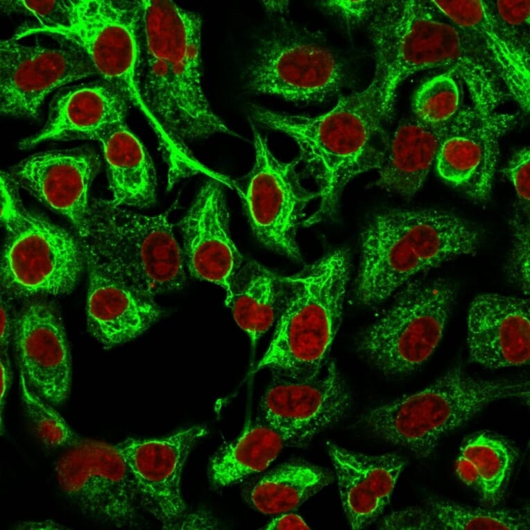 Immunofluorescence - Anti-Cytokeratin 14 Antibody [LL002] (A249173) - Antibodies.com