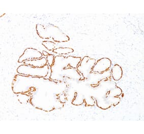 Immunohistochemistry - Anti-Cytokeratin 14 Antibody [SPM263] (A249174) - Antibodies.com