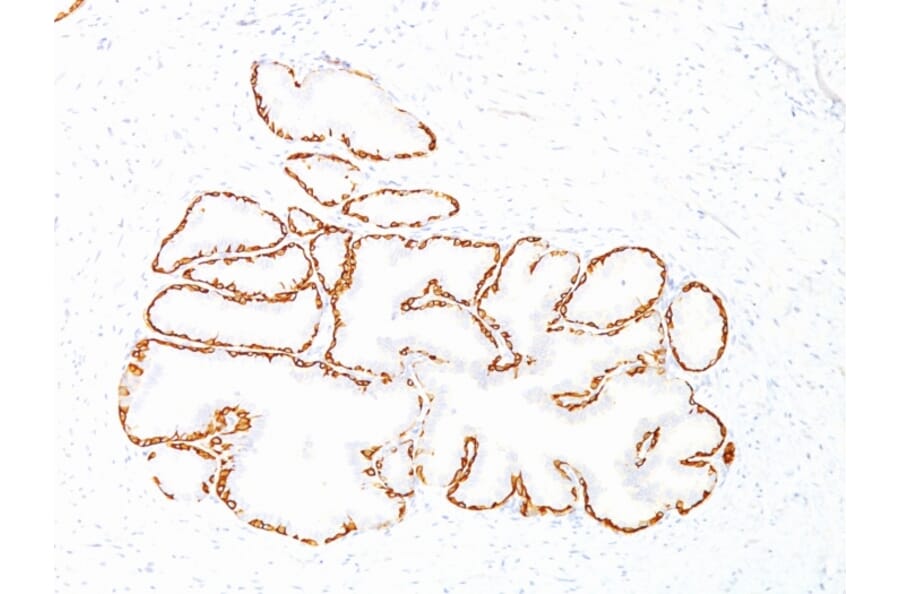 Immunohistochemistry - Anti-Cytokeratin 14 Antibody [SPM263] (A249174) - Antibodies.com