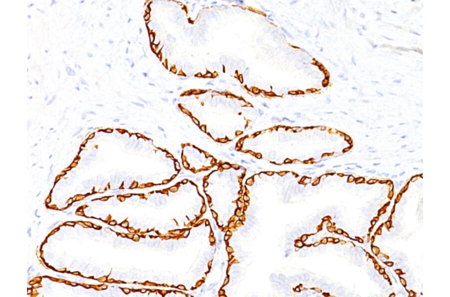 Immunohistochemistry - Anti-Cytokeratin 14 Antibody [SPM263] (A249174) - Antibodies.com