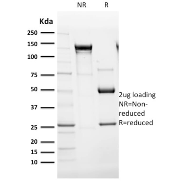 SDS-PAGE - Anti-Cytokeratin 14 Antibody [SPM263] (A249174) - Antibodies.com