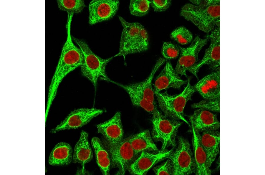 Immunofluorescence - Anti-Cytokeratin 14 Antibody [SPM263] (A249173) - Antibodies.com
