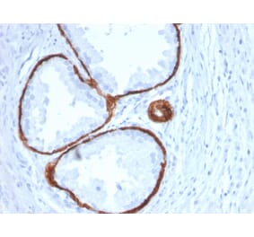 Immunohistochemistry - Anti-Cytokeratin 14 Antibody [KRT14/2375] (A249175) - Antibodies.com