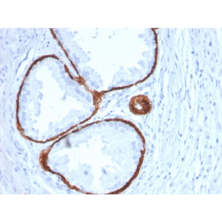 Immunohistochemistry - Anti-Cytokeratin 14 Antibody [KRT14/2375] (A249175) - Antibodies.com