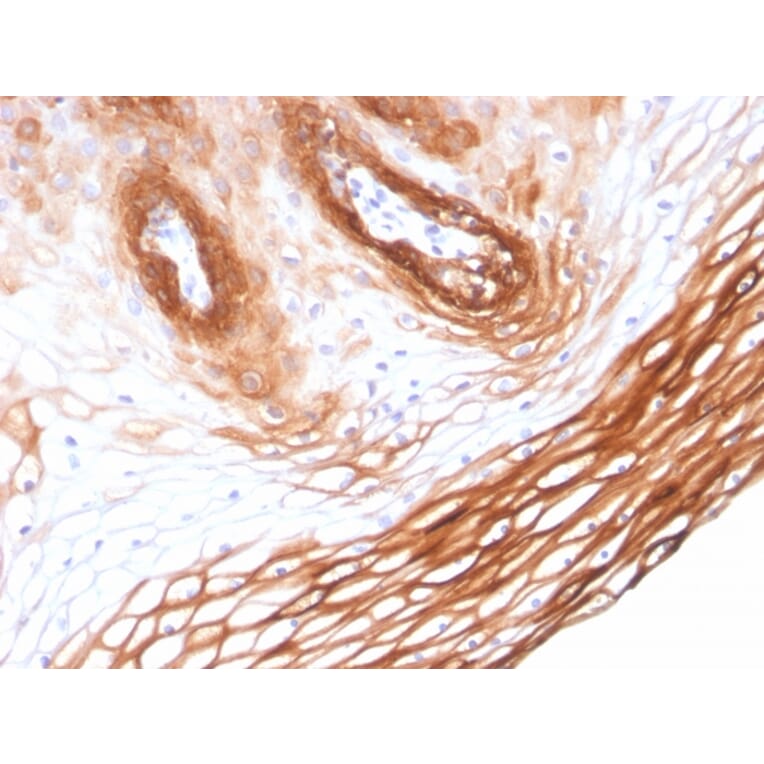 Immunohistochemistry - Anti-Cytokeratin 14 Antibody [KRT14/2375] (A249175) - Antibodies.com