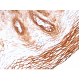 Immunohistochemistry - Anti-Cytokeratin 14 Antibody [KRT14/2375] (A249175) - Antibodies.com