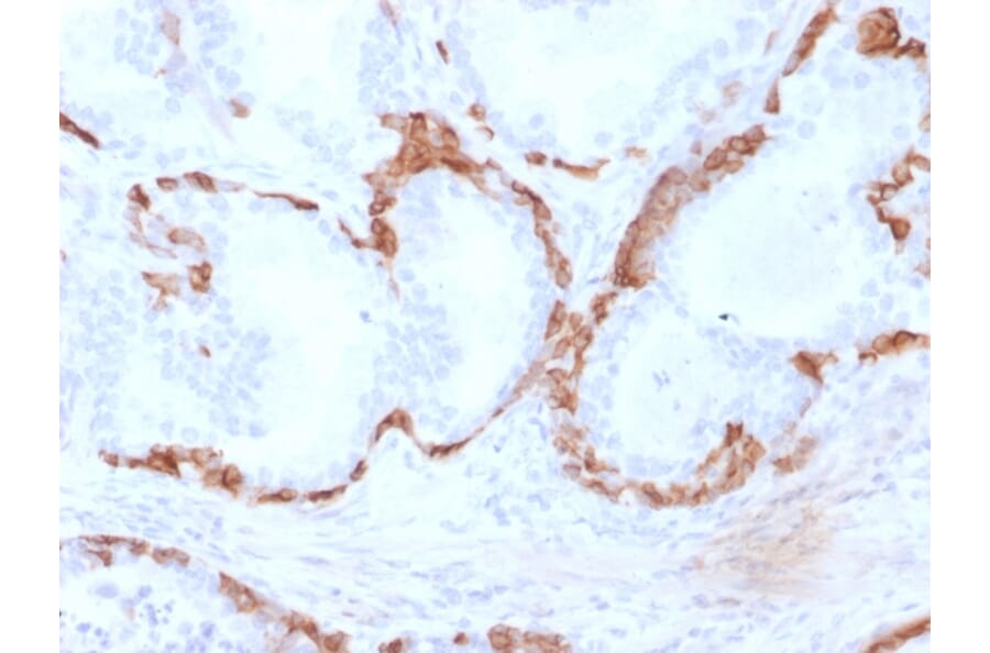 Immunohistochemistry - Anti-Cytokeratin 14 Antibody [KRT14/2375] (A249175) - Antibodies.com