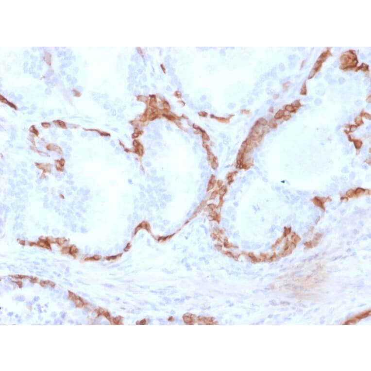 Immunohistochemistry - Anti-Cytokeratin 14 Antibody [KRT14/2375] (A249175) - Antibodies.com