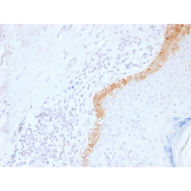 Immunohistochemistry - Anti-Cytokeratin 15 Antibody [LHK15] (A249175) - Antibodies.com