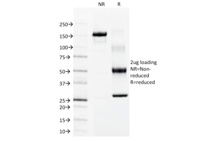 SDS-PAGE - Anti-Cytokeratin 15 Antibody [LHK15] (A249176) - Antibodies.com