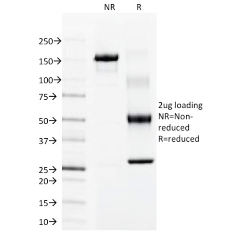 SDS-PAGE - Anti-Cytokeratin 15 Antibody [LHK15] (A249176) - Antibodies.com