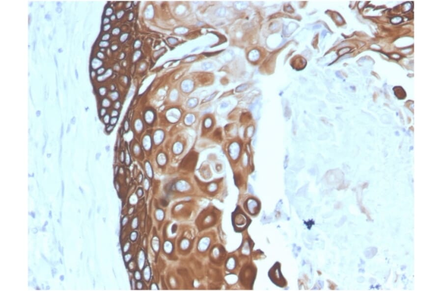 Immunohistochemistry - Anti-Cytokeratin 15 Antibody [SPM190] (A249176) - Antibodies.com