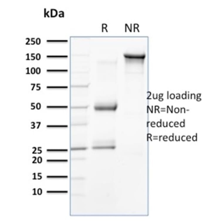 SDS-PAGE - Anti-Cytokeratin 15 Antibody [SPM190] (A249177) - Antibodies.com