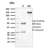 SDS-PAGE - Anti-Cytokeratin 15 Antibody [SPM190] (A249177) - Antibodies.com