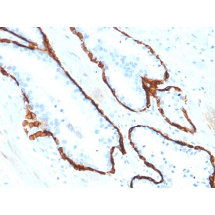 Immunohistochemistry - Anti-Cytokeratin 15 Antibody [KRT15/2554] (A249179) - Antibodies.com