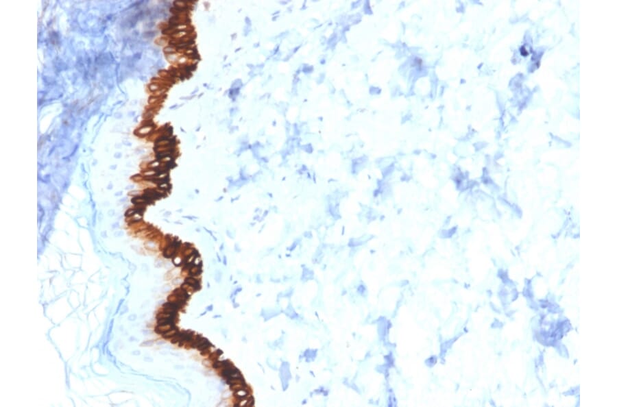 Immunohistochemistry - Anti-Cytokeratin 15 Antibody [KRT15/2554] (A249179) - Antibodies.com