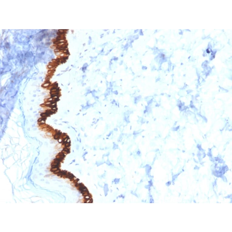 Immunohistochemistry - Anti-Cytokeratin 15 Antibody [KRT15/2554] (A249179) - Antibodies.com