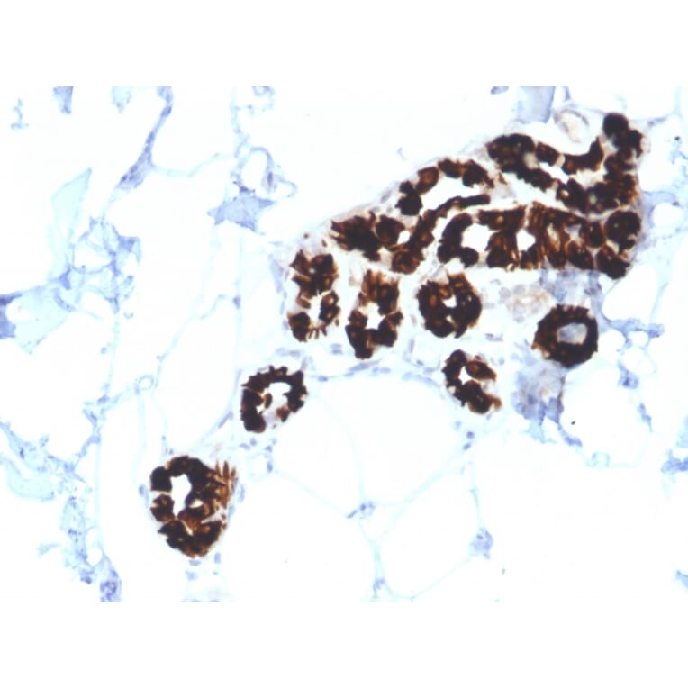 Immunohistochemistry - Anti-Cytokeratin 15 Antibody [KRT15/2554] (A249179) - Antibodies.com