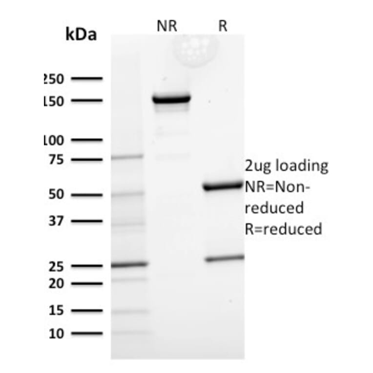 SDS-PAGE - Anti-Cytokeratin 15 Antibody [KRT15/2554] (A249179) - Antibodies.com