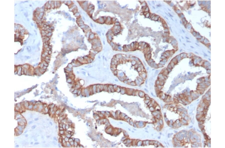 Immunohistochemistry - Anti-Cytokeratin 15 Antibody [KRT15/2957] (A249180) - Antibodies.com