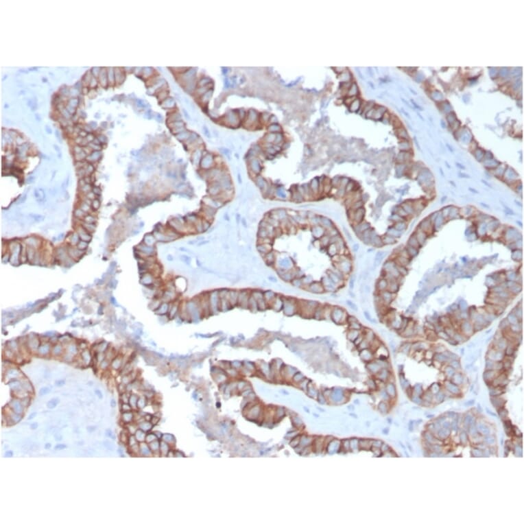 Immunohistochemistry - Anti-Cytokeratin 15 Antibody [KRT15/2957] (A249180) - Antibodies.com