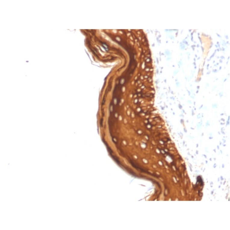 Immunohistochemistry - Anti-Cytokeratin 15 Antibody [KRT15/2957] (A249180) - Antibodies.com