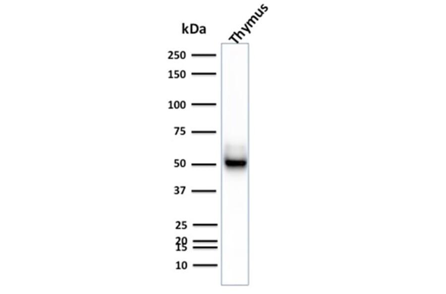 Western Blot - Anti-Cytokeratin 15 Antibody [KRT15/2957] (A249180) - Antibodies.com