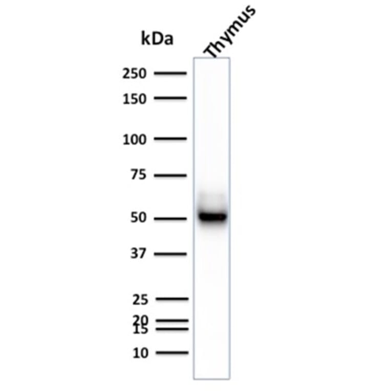 Western Blot - Anti-Cytokeratin 15 Antibody [KRT15/2957] (A249180) - Antibodies.com