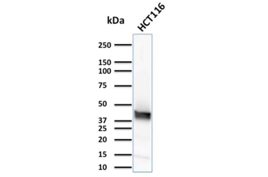 Western Blot - Anti-Cytokeratin 15 Antibody [KRT15/2957] (A249180) - Antibodies.com
