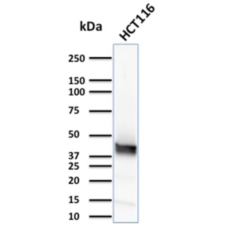 Western Blot - Anti-Cytokeratin 15 Antibody [KRT15/2957] (A249180) - Antibodies.com