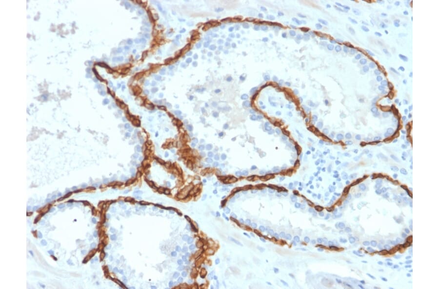 Immunohistochemistry - Anti-Cytokeratin 15 Antibody [KRT15/2958] (A249181) - Antibodies.com
