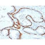 Immunohistochemistry - Anti-Cytokeratin 15 Antibody [KRT15/2958] (A249181) - Antibodies.com