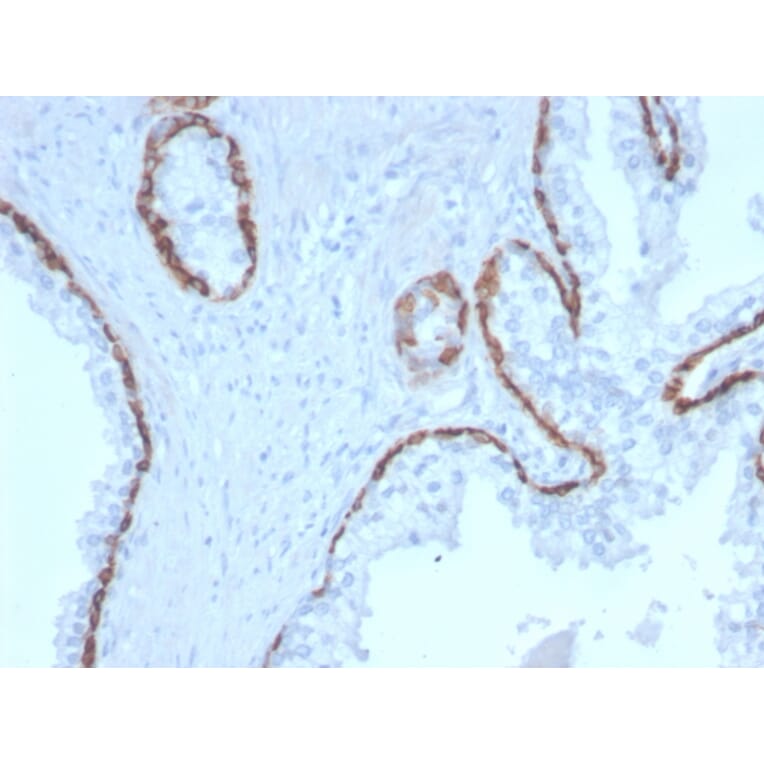 Immunohistochemistry - Anti-Cytokeratin 15 Antibody [KRT15/2958] (A249181) - Antibodies.com