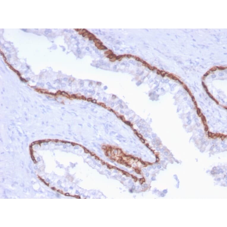 Immunohistochemistry - Anti-Cytokeratin 15 Antibody [KRT15/2959] (A249182) - Antibodies.com