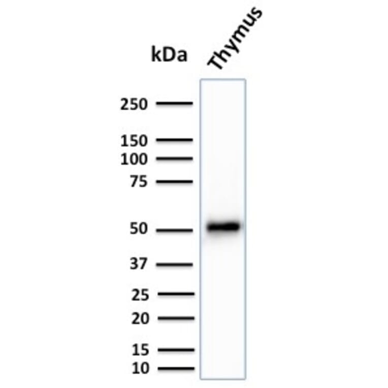 Western Blot - Anti-Cytokeratin 15 Antibody [KRT15/2959] (A249182) - Antibodies.com