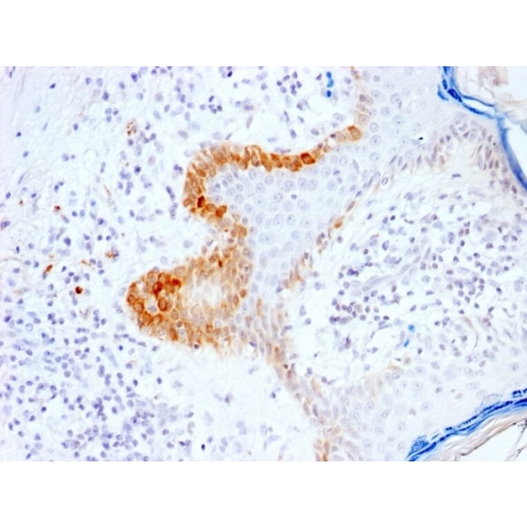 Immunohistochemistry - Anti-Cytokeratin 15 Antibody [KRT15/2103R] (A249183) - Antibodies.com