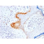 Immunohistochemistry - Anti-Cytokeratin 15 Antibody [KRT15/2103R] (A249183) - Antibodies.com