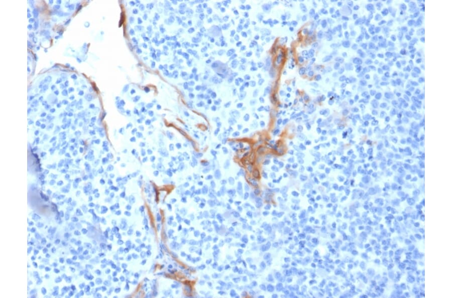 Immunohistochemistry - Anti-Cytokeratin 16 Antibody [LL025] (A249183) - Antibodies.com