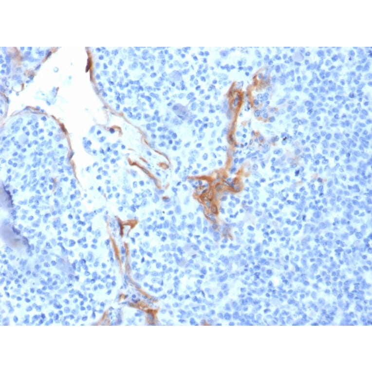 Immunohistochemistry - Anti-Cytokeratin 16 Antibody [LL025] (A249183) - Antibodies.com