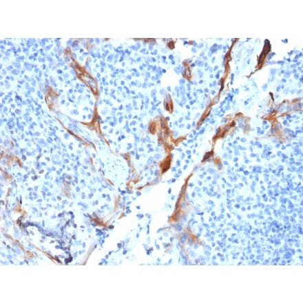 Immunohistochemistry - Anti-Cytokeratin 16 Antibody [KRT16/1714] (A249184) - Antibodies.com
