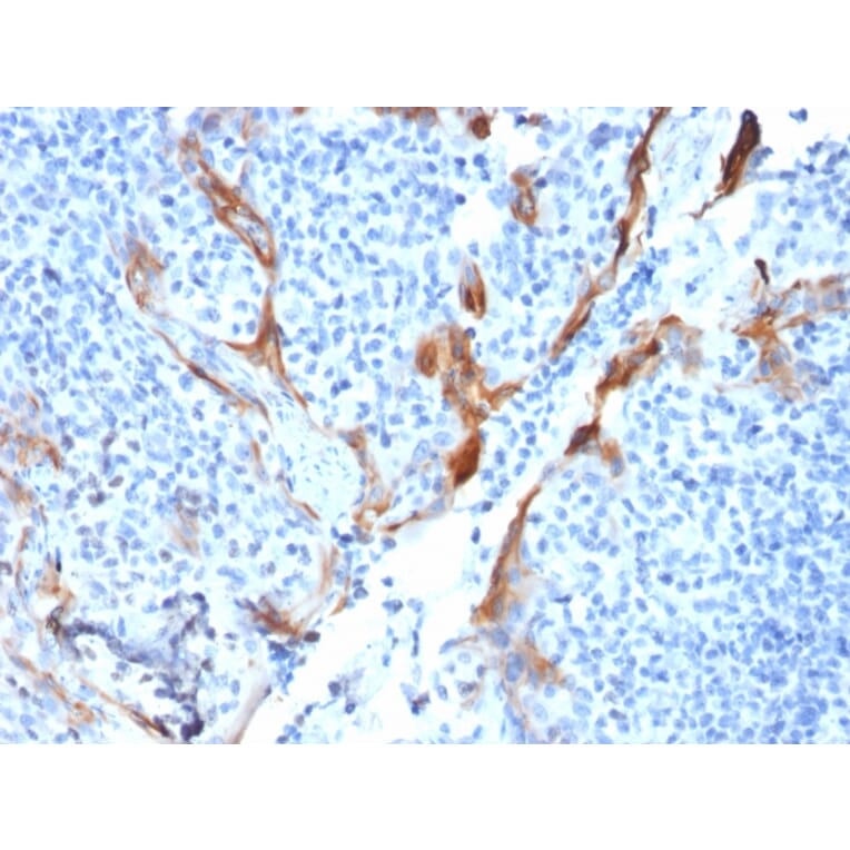 Immunohistochemistry - Anti-Cytokeratin 16 Antibody [KRT16/1714] (A249184) - Antibodies.com