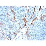 Immunohistochemistry - Anti-Cytokeratin 16 Antibody [KRT16/1714] (A249184) - Antibodies.com