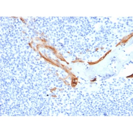 Immunohistochemistry - Anti-Cytokeratin 16 Antibody [SPM264] (A249185) - Antibodies.com