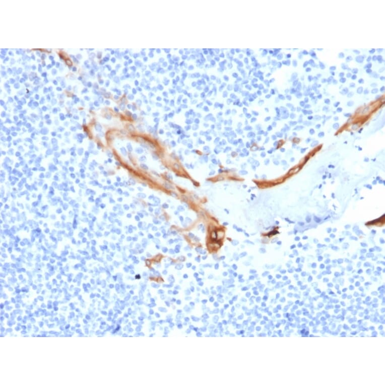Immunohistochemistry - Anti-Cytokeratin 16 Antibody [SPM264] (A249185) - Antibodies.com