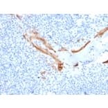 Immunohistochemistry - Anti-Cytokeratin 16 Antibody [SPM264] (A249185) - Antibodies.com