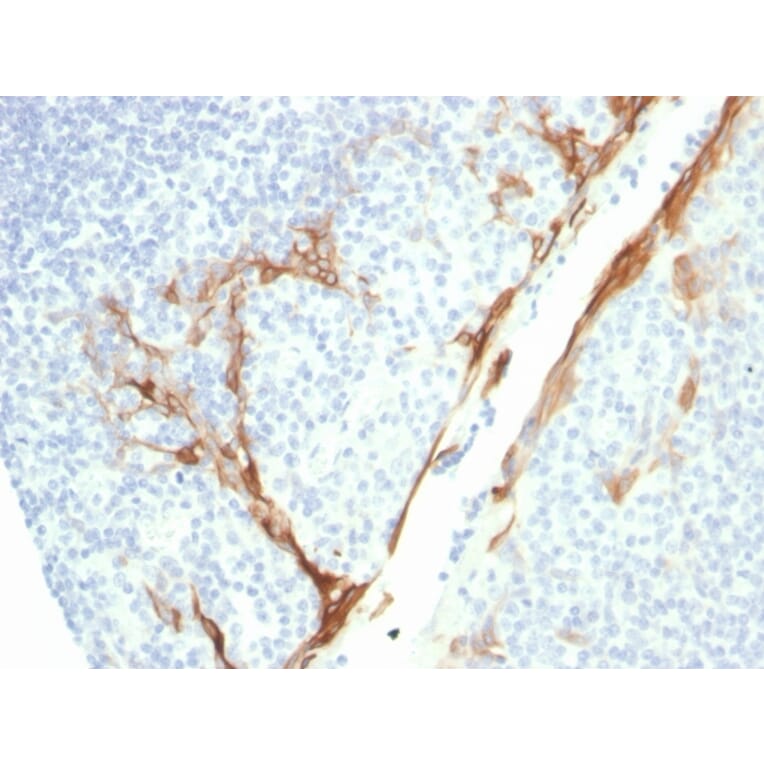 Immunohistochemistry - Anti-Cytokeratin 16 Antibody [rKRT16/1714] (A249186) - Antibodies.com