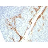 Immunohistochemistry - Anti-Cytokeratin 16 Antibody [rKRT16/1714] (A249186) - Antibodies.com